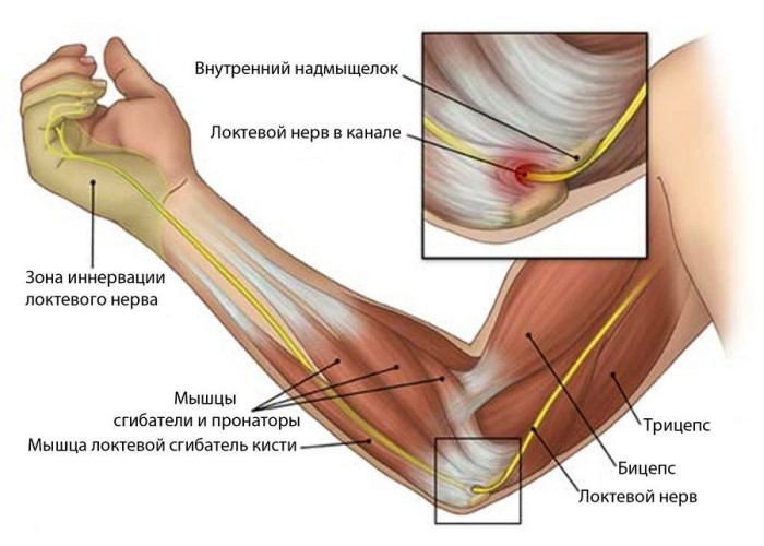 Боль в руке от запястья до локтя