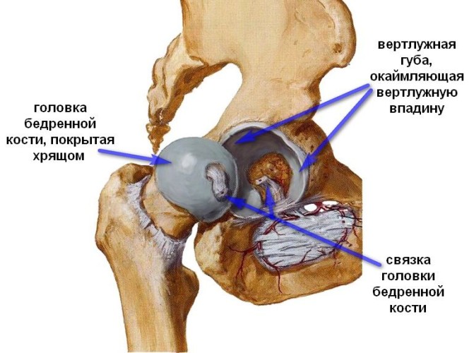 Бурсит бедренной кости