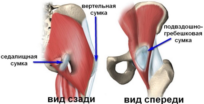 Бурсит вертельной сумки