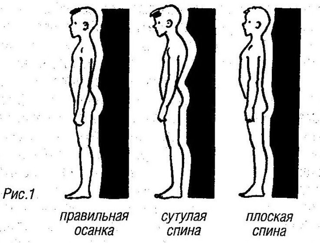 Правильное положение позвоночника