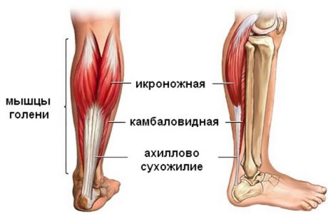 Воспаление ахилла