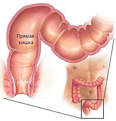 Прямая кишка
