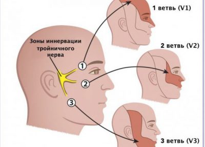 Невралгия тройничного нерва